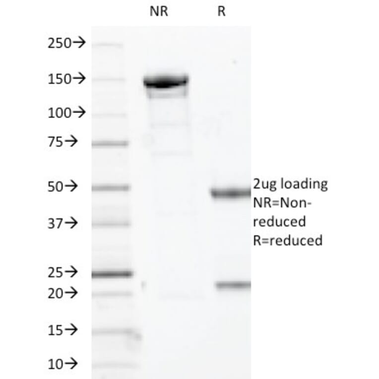 SDS-PAGE - Anti-SOX10 Antibody [SOX10/1074] - BSA and Azide free (A253195) - Antibodies.com