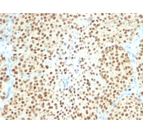 Immunohistochemistry - Anti-SOX10 Antibody [SPM607] - BSA and Azide free (A253195) - Antibodies.com