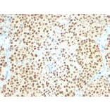 Immunohistochemistry - Anti-SOX10 Antibody [SPM607] - BSA and Azide free (A253195) - Antibodies.com