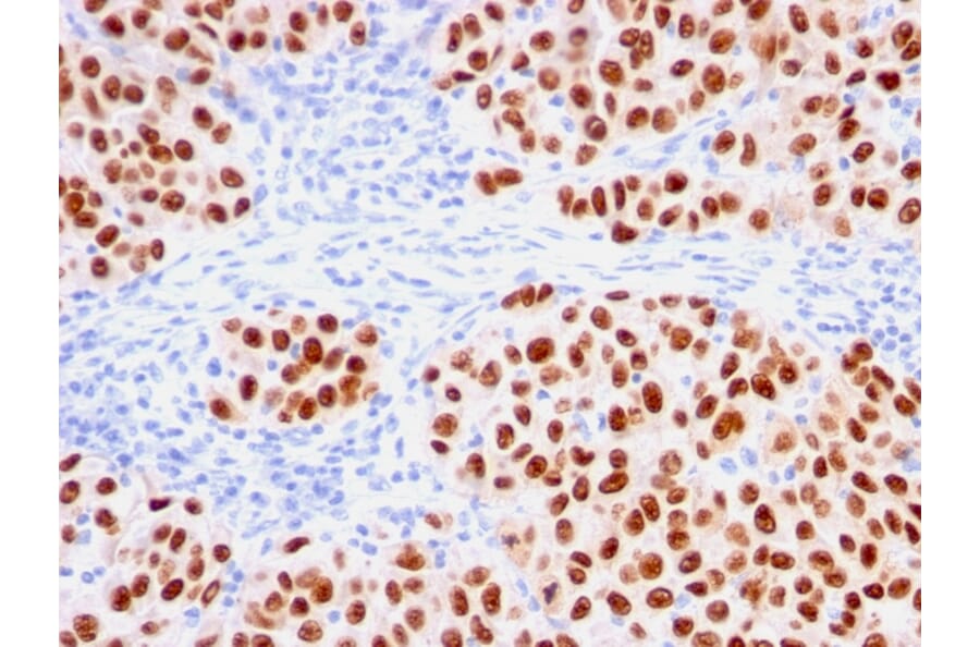 Immunohistochemistry - Anti-SOX10 Antibody [rSOX10/1074] - BSA and Azide free (A253197) - Antibodies.com