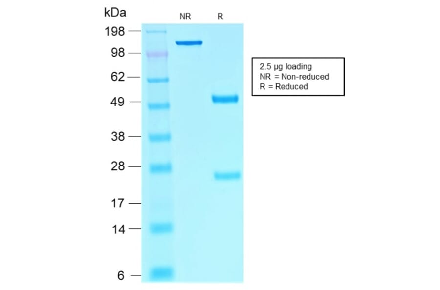 SDS-PAGE - Anti-SOX10 Antibody [rSOX10/1074] - BSA and Azide free (A253197) - Antibodies.com