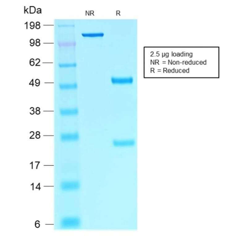 SDS-PAGE - Anti-SOX10 Antibody [rSOX10/1074] - BSA and Azide free (A253197) - Antibodies.com