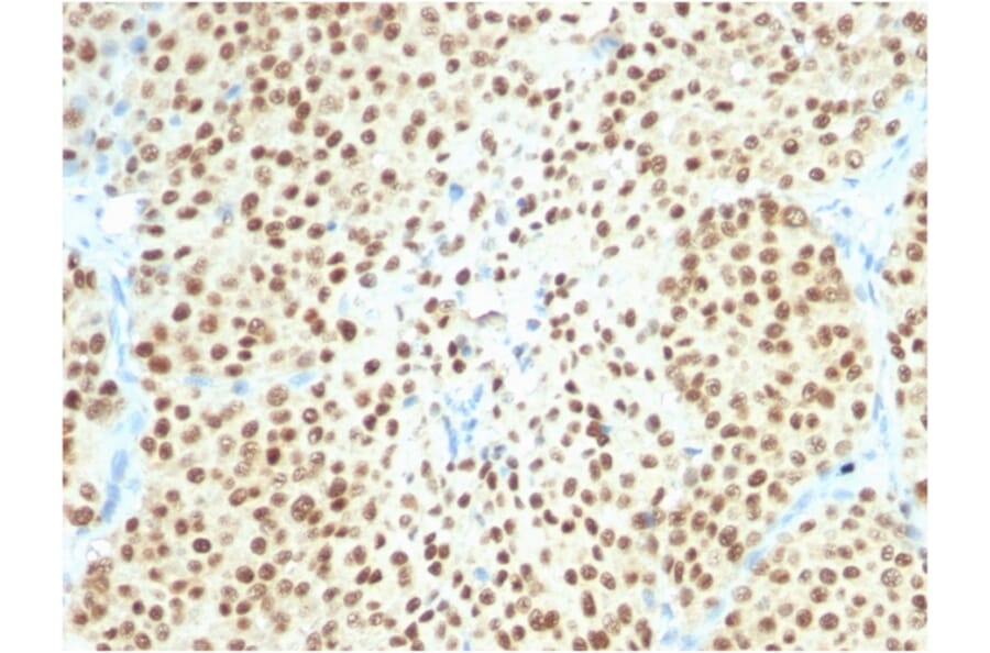 Immunohistochemistry - Anti-SOX10 Antibody [SOX10/2311R] - BSA and Azide free (A253199) - Antibodies.com