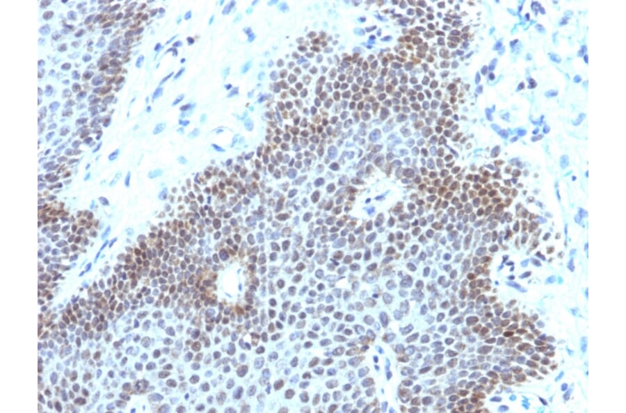 Immunohistochemistry - Anti-SOX11 Antibody [SOX11/3235R] - BSA and Azide free (A253199) - Antibodies.com