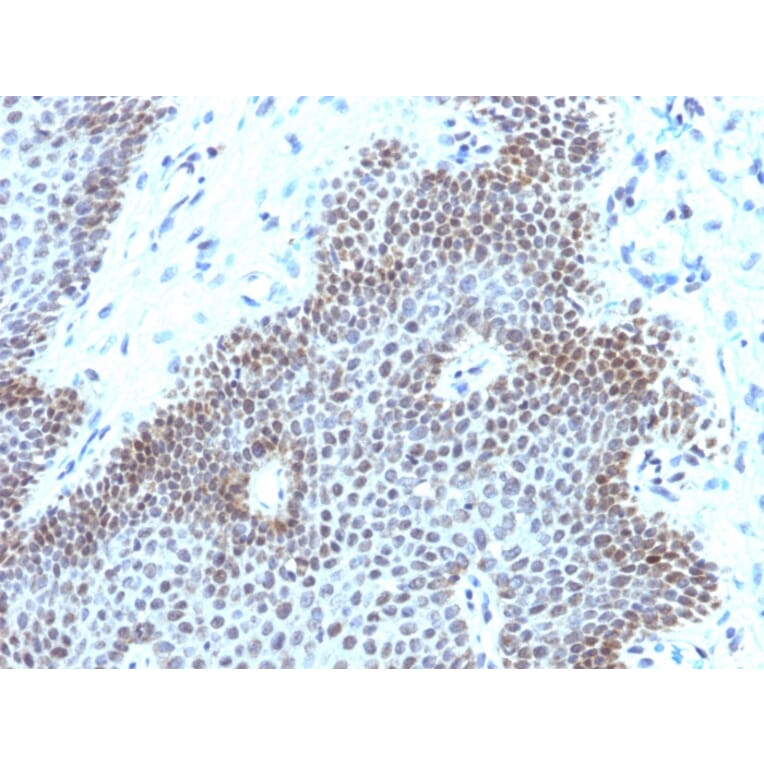 Immunohistochemistry - Anti-SOX11 Antibody [SOX11/3235R] - BSA and Azide free (A253199) - Antibodies.com