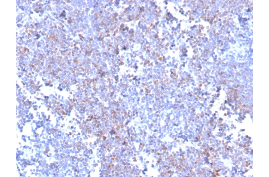 Immunohistochemistry - Anti-SOX11 Antibody [SOX11/3235R] - BSA and Azide free (A253200) - Antibodies.com