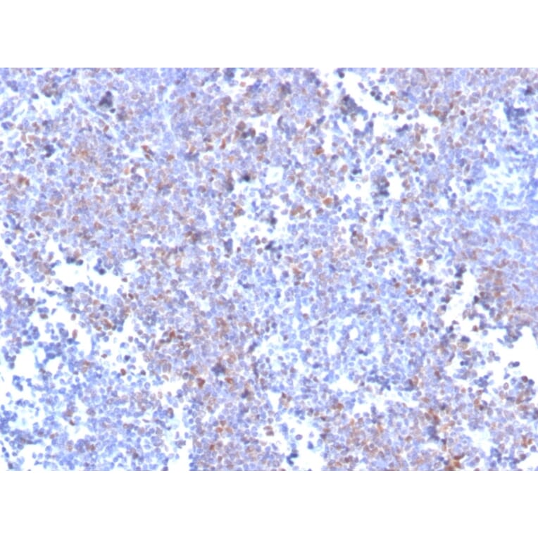 Immunohistochemistry - Anti-SOX11 Antibody [SOX11/3235R] - BSA and Azide free (A253200) - Antibodies.com