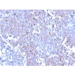 Immunohistochemistry - Anti-SOX11 Antibody [SOX11/3235R] - BSA and Azide free (A253200) - Antibodies.com