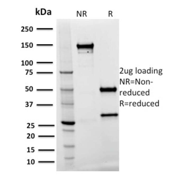 SDS-PAGE - Anti-Spastin Antibody [Sp 3G11-1] - BSA and Azide free (A253200) - Antibodies.com