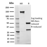 SDS-PAGE - Anti-Spastin Antibody [Sp 3G11-1] - BSA and Azide free (A253200) - Antibodies.com