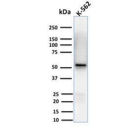Western Blot - Anti-Spastin Antibody [Sp 6C6] - BSA and Azide free (A253202) - Antibodies.com