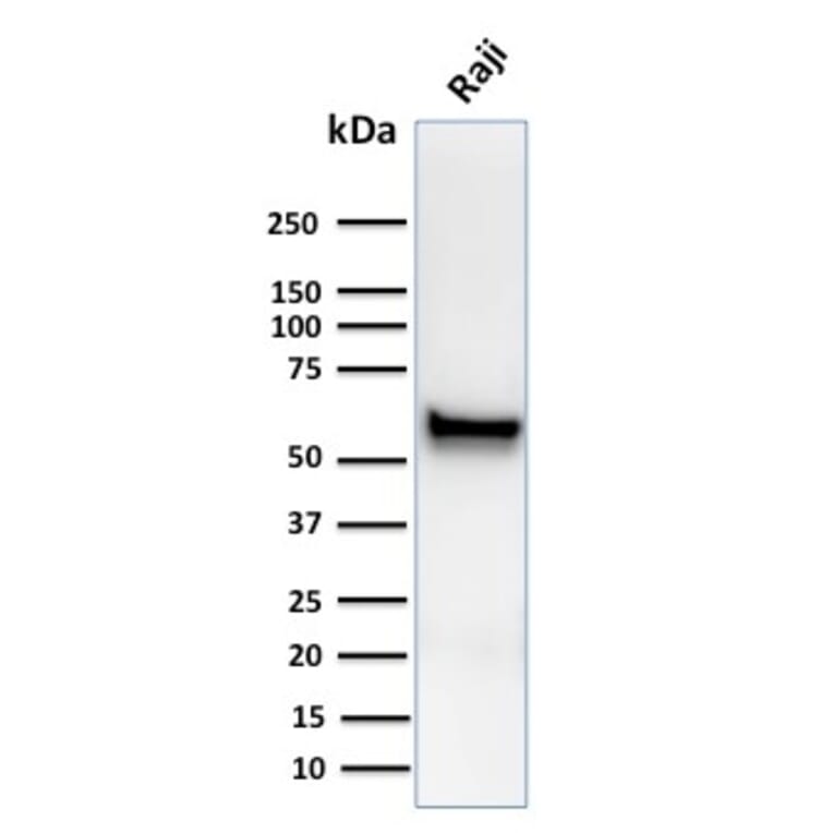 Western Blot - Anti-Spastin Antibody [Sp 6C6] - BSA and Azide free (A253202) - Antibodies.com