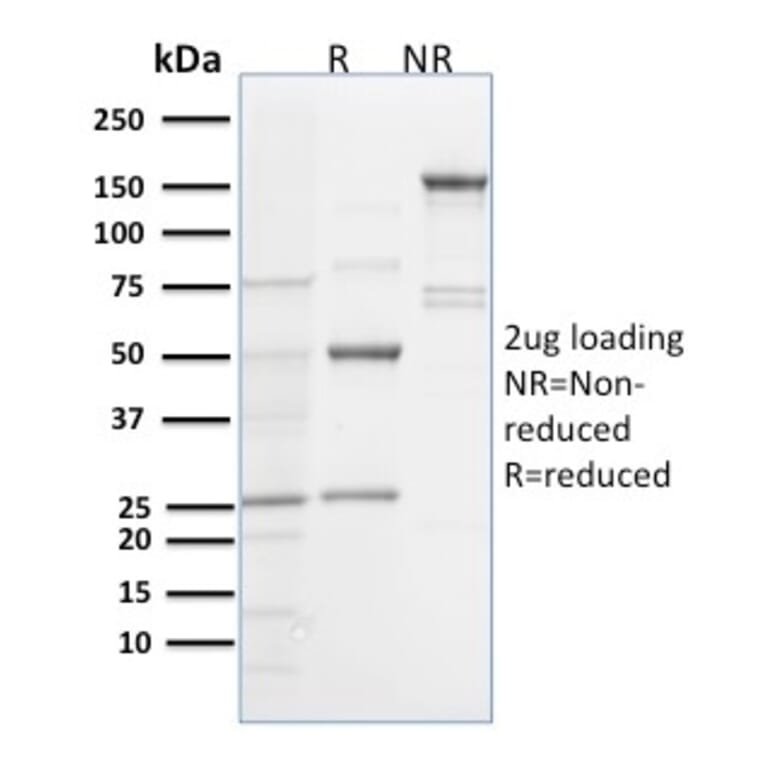 SDS-PAGE - Anti-Spastin Antibody [Sp 6C6] - BSA and Azide free (A253201) - Antibodies.com