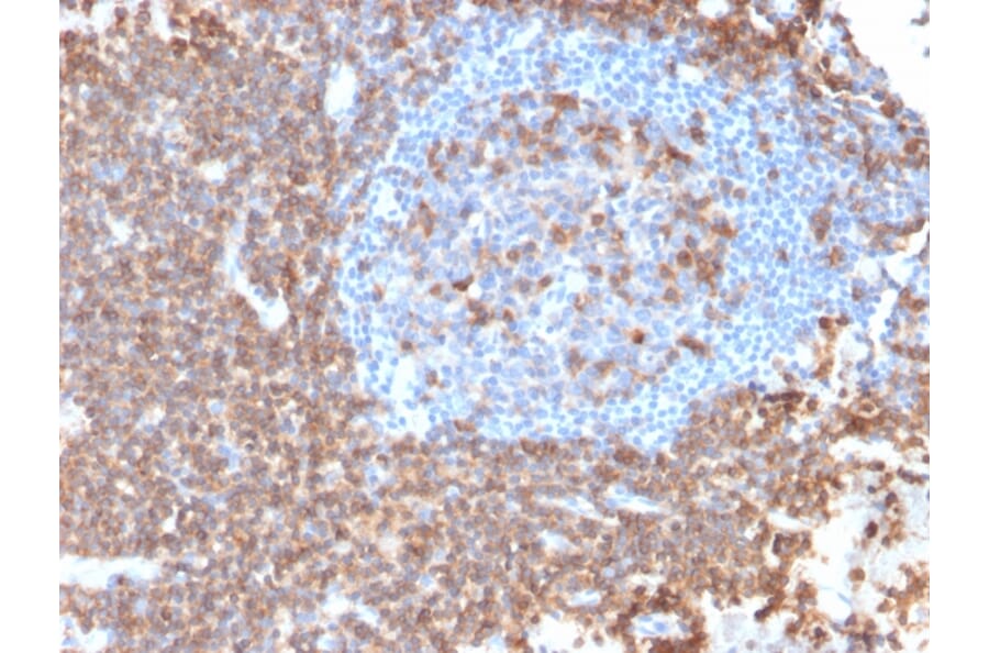 Immunohistochemistry - Anti-CD43 Antibody [rSPN/839] - BSA and Azide free (A253204) - Antibodies.com