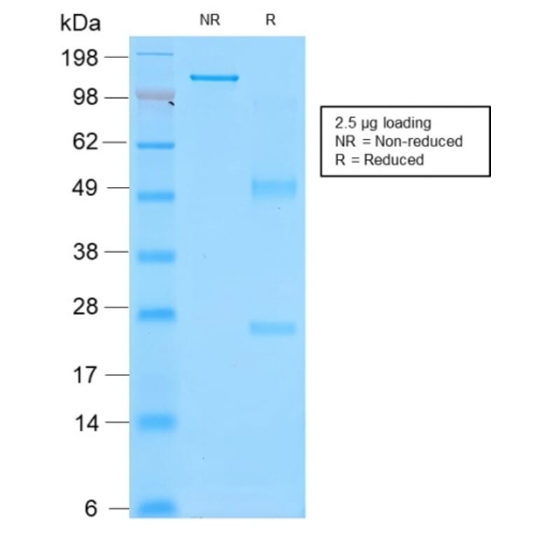 SDS-PAGE - Anti-CD43 Antibody [rSPN/839] - BSA and Azide free (A253204) - Antibodies.com