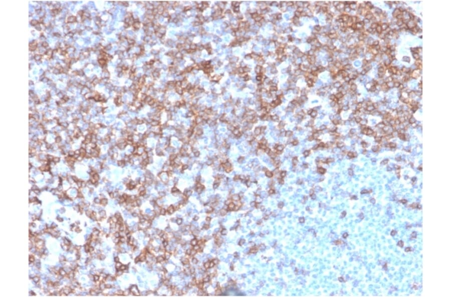 Immunohistochemistry - Anti-CD43 Antibody [SPN/3388] - BSA and Azide free (A253205) - Antibodies.com