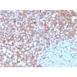 Immunohistochemistry - Anti-CD43 Antibody [SPN/3388] - BSA and Azide free (A253205) - Antibodies.com