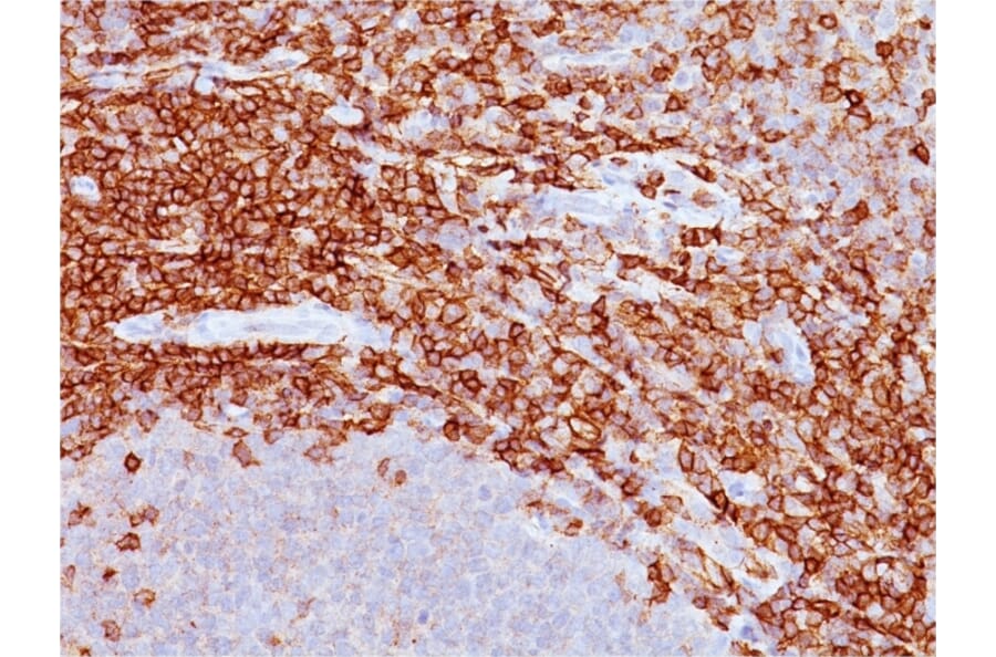 Immunohistochemistry - Anti-CD43 Antibody [DF-T1] - BSA and Azide free (A253206) - Antibodies.com