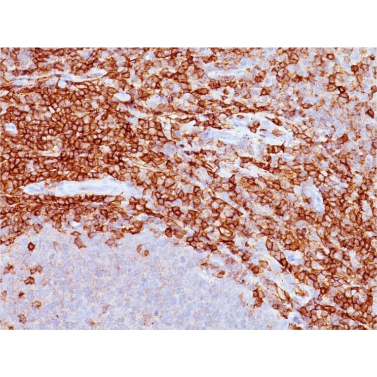 Immunohistochemistry - Anti-CD43 Antibody [DF-T1] - BSA and Azide free (A253206) - Antibodies.com