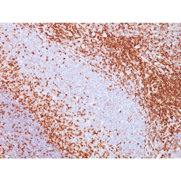 Immunohistochemistry - Anti-CD43 Antibody [SPM503] - BSA and Azide free (A253207) - Antibodies.com