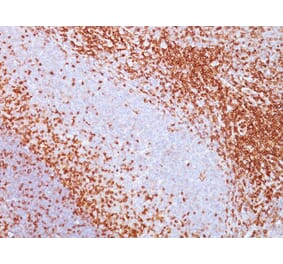Immunohistochemistry - Anti-CD43 Antibody [SPN/839] - BSA and Azide free (A253208) - Antibodies.com