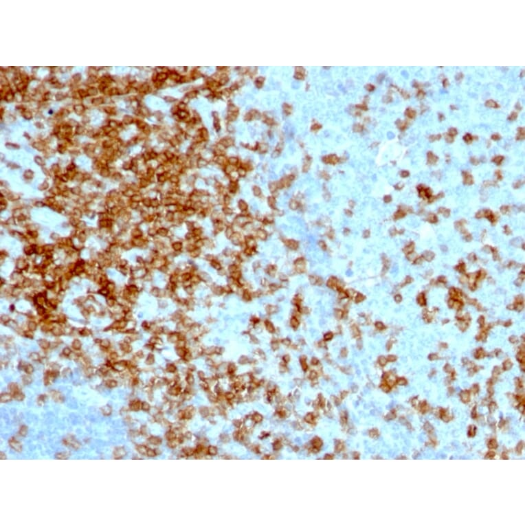 Immunohistochemistry - Anti-CD43 Antibody [84-3C1] - BSA and Azide free (A253209) - Antibodies.com