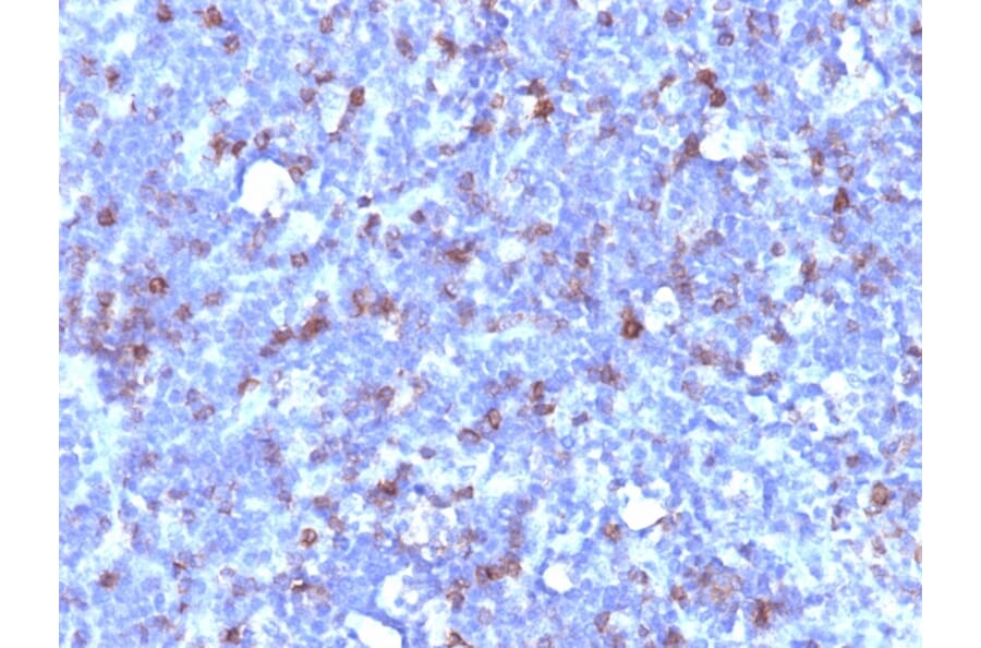 Immunohistochemistry - Anti-CD43 Antibody [SPN/1094] - BSA and Azide free (A253210) - Antibodies.com