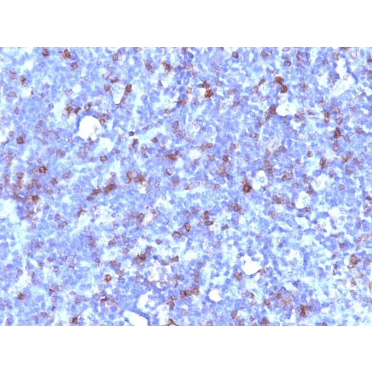 Immunohistochemistry - Anti-CD43 Antibody [SPN/1094] - BSA and Azide free (A253210) - Antibodies.com