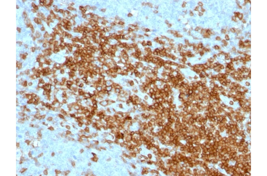 Immunohistochemistry - Anti-CD43 Antibody [SPN/1094] - BSA and Azide free (A253210) - Antibodies.com