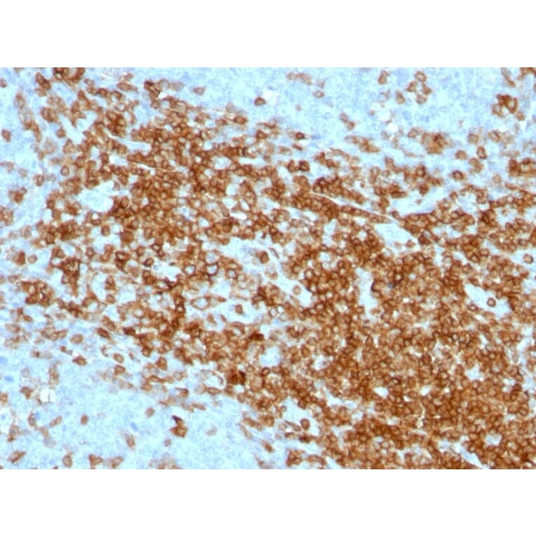 Immunohistochemistry - Anti-CD43 Antibody [SPN/1094] - BSA and Azide free (A253210) - Antibodies.com