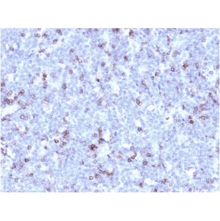 Immunohistochemistry - Anti-CD43 Antibody [rSPN/1094] - BSA and Azide free (A253211) - Antibodies.com