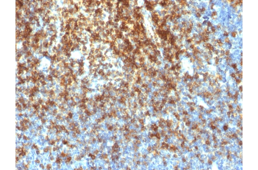 Immunohistochemistry - Anti-CD43 Antibody [SPN/1766R] - BSA and Azide free (A253212) - Antibodies.com