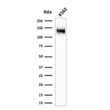 Western Blot - Anti-CD43 Antibody [SPN/1766R] - BSA and Azide free (A253212) - Antibodies.com