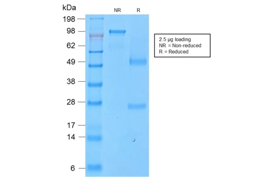 SDS-PAGE - Anti-CD43 Antibody [SPN/2049R] - BSA and Azide free (A253213) - Antibodies.com