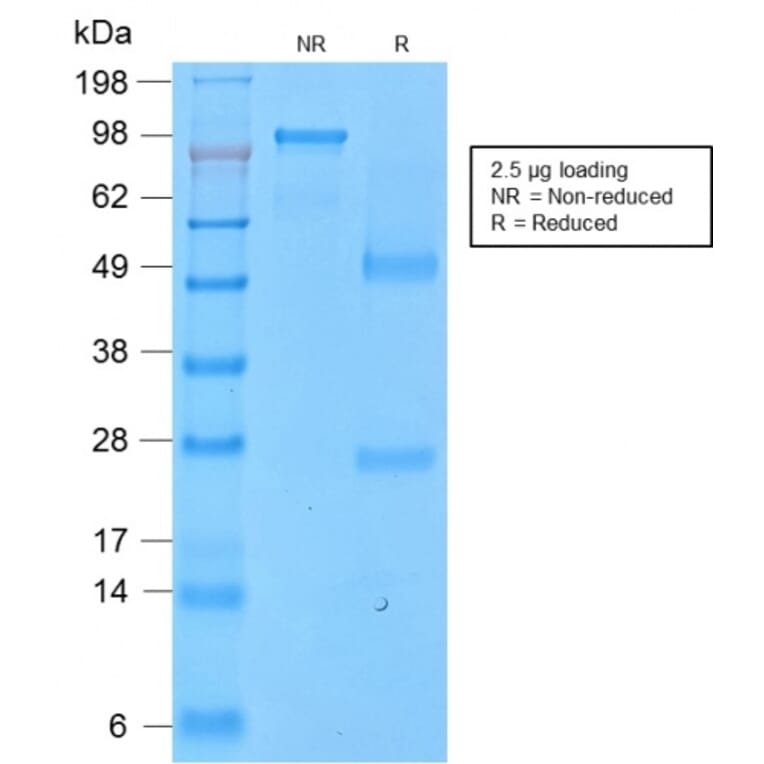 SDS-PAGE - Anti-CD43 Antibody [SPN/2049R] - BSA and Azide free (A253213) - Antibodies.com