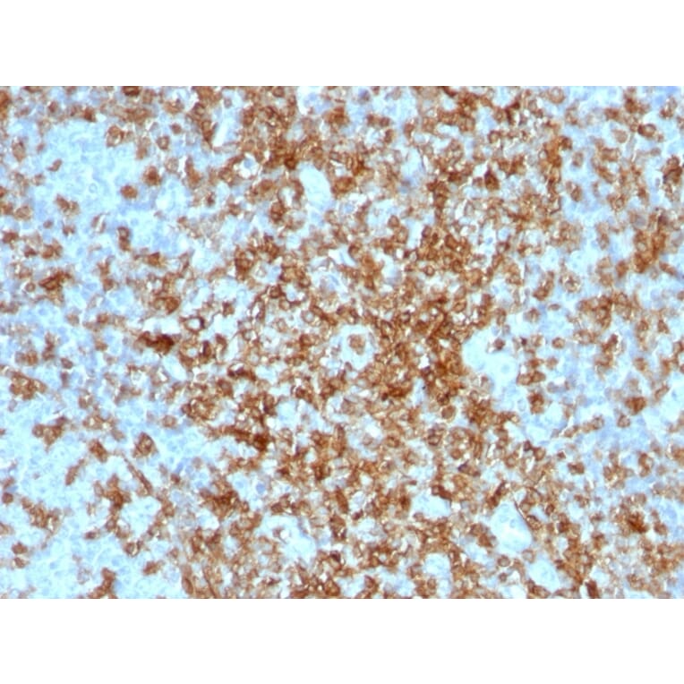 Immunohistochemistry - Anti-CD43 Antibody - BSA and Azide free (A253213) - Antibodies.com