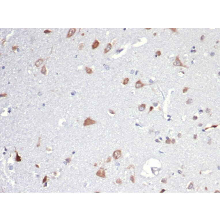 Immunohistochemistry - Anti-Osteopontin Antibody [OSP/4589] - BSA and Azide free (A253214) - Antibodies.com
