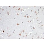 Immunohistochemistry - Anti-Osteopontin Antibody [OSP/4589] - BSA and Azide free (A253214) - Antibodies.com