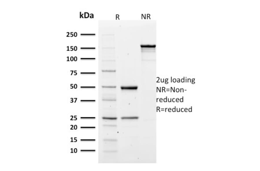 SDS-PAGE - Anti-alpha 1 Spectrin Antibody [SPTA1/1810] - BSA and Azide free (A253216) - Antibodies.com