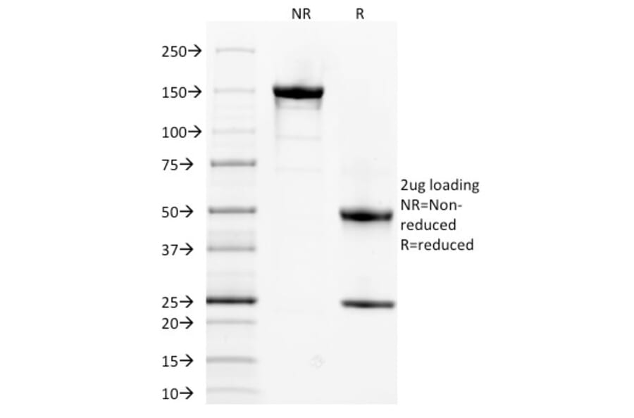 SDS-PAGE - Anti-alpha 1 Spectrin Antibody [SPTA1/1832] - BSA and Azide free (A253217) - Antibodies.com