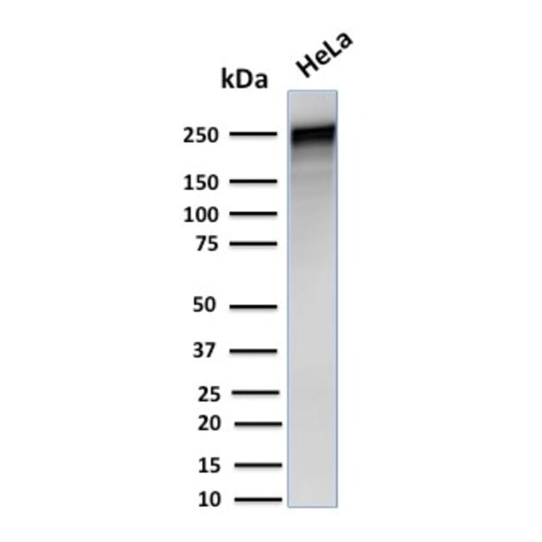 Western Blot - Anti-alpha 1 Spectrin Antibody [SPTA1/1832] - BSA and Azide free (A253217) - Antibodies.com