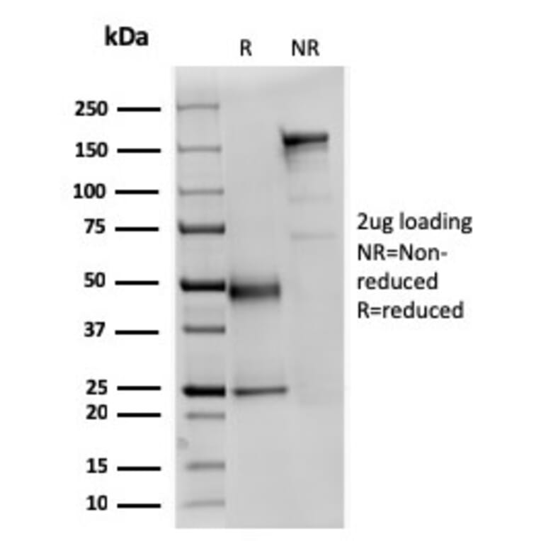 SDS-PAGE - Anti-alpha Fodrin Antibody [SPTAN1/3351] - BSA and Azide free (A253220) - Antibodies.com