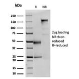 SDS-PAGE - Anti-alpha Fodrin Antibody [SPTAN1/3351] - BSA and Azide free (A253220) - Antibodies.com