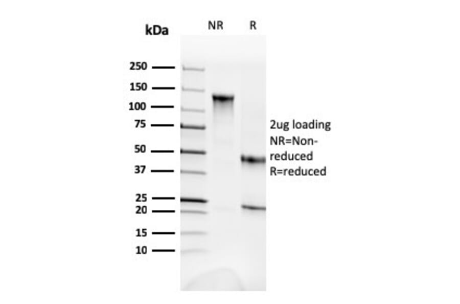SDS-PAGE - Anti-alpha Fodrin Antibody [SPTAN1/3352] - BSA and Azide free (A253221) - Antibodies.com