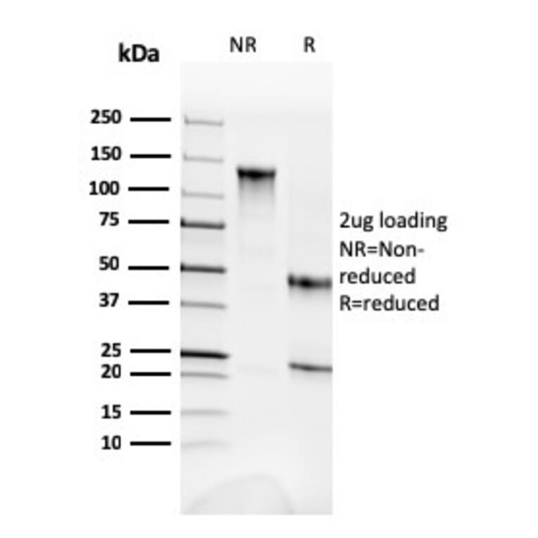 SDS-PAGE - Anti-alpha Fodrin Antibody [SPTAN1/3352] - BSA and Azide free (A253221) - Antibodies.com