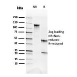 SDS-PAGE - Anti-alpha Fodrin Antibody [SPTAN1/3352] - BSA and Azide free (A253221) - Antibodies.com