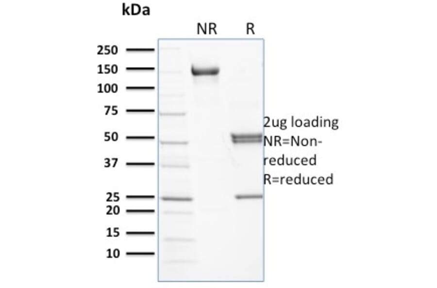 SDS-PAGE - Anti-beta III Spectrin Antibody [RG/26] - BSA and Azide free (A253221) - Antibodies.com
