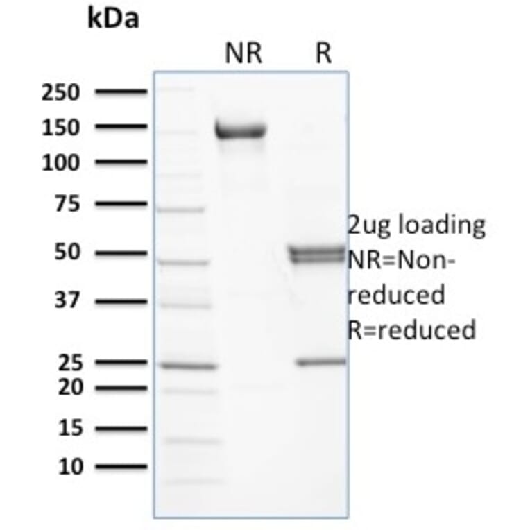 SDS-PAGE - Anti-beta III Spectrin Antibody [RG/26] - BSA and Azide free (A253221) - Antibodies.com