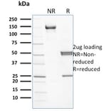 SDS-PAGE - Anti-beta III Spectrin Antibody [RG/26] - BSA and Azide free (A253221) - Antibodies.com