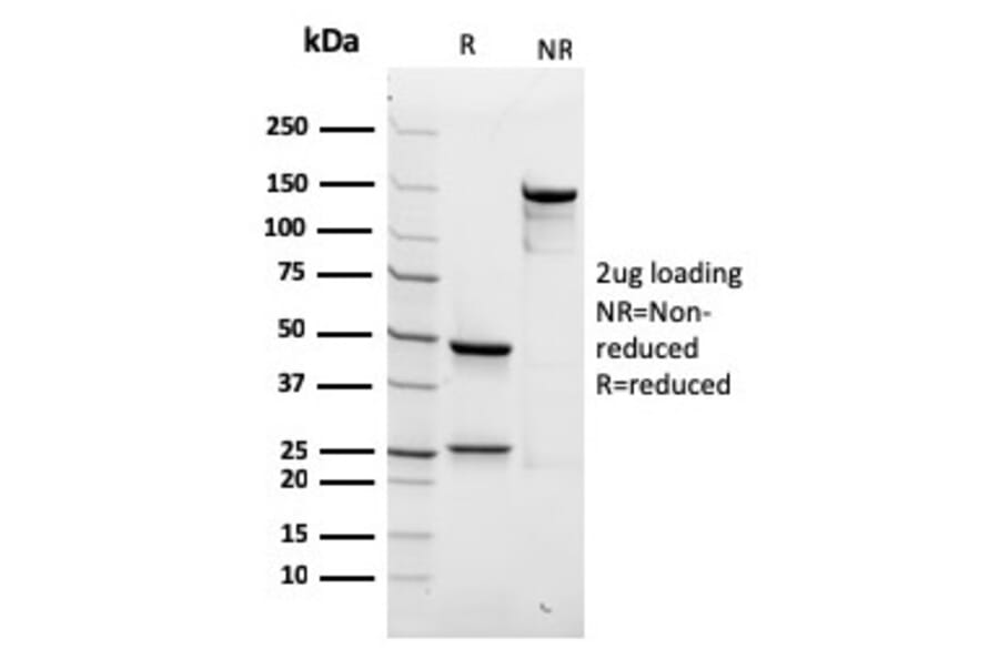 SDS-PAGE - Anti-beta III Spectrin Antibody [rSPTBN2/1778] - BSA and Azide free (A253223) - Antibodies.com